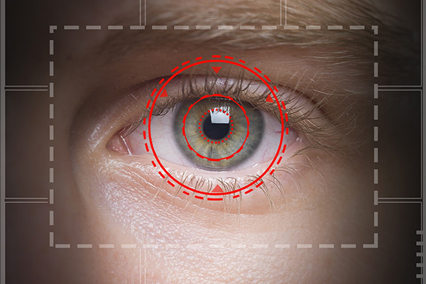 eye - mssi